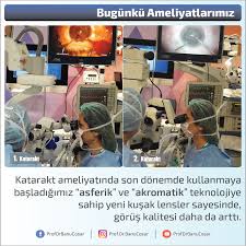 Katarakt Ameliyatinda Son Donemde Kullanmaya Basladigimiz Asferik Ve Akromatik Teknolojiye Sahip Yeni Kusak Lensler Sayesinde Gorus Ka Teknoloji Danca Oya