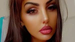 Pamplona festival sees first gorings with three impaled by bulls