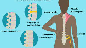 We did not find results for: Back Pain Causes Treatment And When To See A Doctor