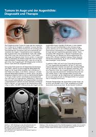 Tumore Im Auge Und Der Augenhohle Diagnostik Und