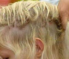 Pakar menyelesaikan rambut gugor lepas bersalin memang mimpi ngeri. Saya Bermimpi Bahawa Rambut Gugur Mimpi Buku Akan Memberitahu Nilai