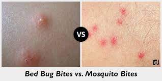 difference between bed bug bites and mosquito bites bed bug bites bed bugs bug bites