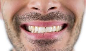 We did not find results for: Why Are My Teeth Becoming Transparent New Leaf Rohnert Park
