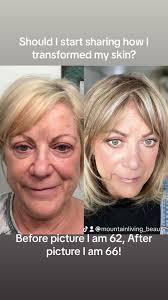 5 months to a new face with Pomifera products