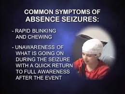 Call your doctor to have your child evaluated as soon as possible after a febrile seizure. Managing Seizures In Children Youtube