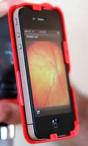 Iexaminer For Iphone 4 Liberates Fundus Exams Health App Eye Care Kids App