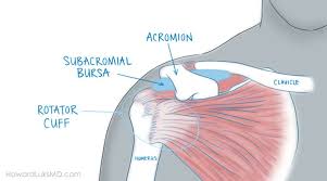 Pain in the general shoulder area, often difficult to pinpoint, can sometimes be related to a herniated disc in the neck or gallbladder disease. Rotator Cuff Tears And Shoulder Pain At Night