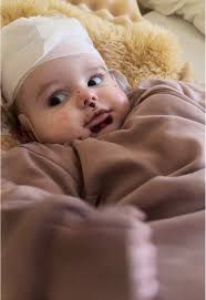 Morning Routine with My Girls and Epidermolysis Bullosa