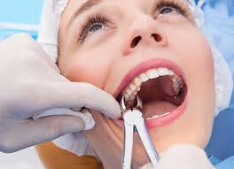 Tooth Extraction in Dwarka