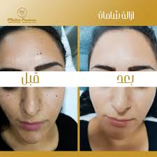 Dr Raghad youssef (@dr.raghad.youssef) • Instagram photos and videos