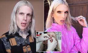 Septum and the lil bump i had on the bridge of my nose, keech announced, before unveiling her nose job. Jeffree Star Reveals A Doctor Secretly Injected His Lips With Silicone Daily Mail Online