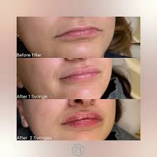 Nouveau Health & Wellness (@nouveauhealthwellness) • Instagram photos and  videos