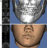 Table of Contents page: Journal of Oral and Maxillofacial Surgery