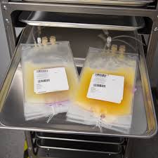 Image result for Platelet Transfusion
