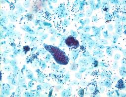 Cytopathology Conference