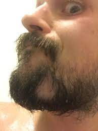 I have a hole in my beard... : rbeards