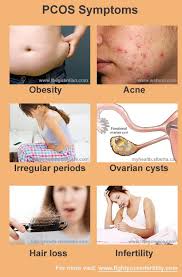 Hormonal Imbalance And Pcos Three Must Follow Dietary Principles Pcos Pcos Hair Loss Treatment Hormone Imbalance