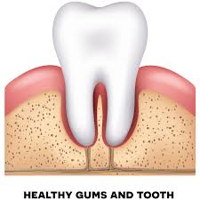 Tell your dentist if you recognize any of these symptoms of. Gum Disease Therapy Julie Stante Dds