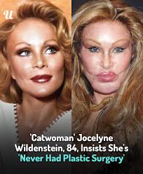 The socialite claims she's never had any work done 😲