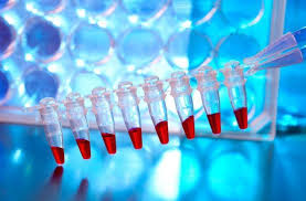 We did not find results for: Polimeraz Zincir Reaksiyonu Nedir Pcr Nedir Nasil Yapilir Ve Tibbi Onemi