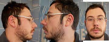 In some instances it may only soften, rather than remove, hair. Here Is My Beard After 4 Weeks Of Growth Due To Low Density On The Chin It Looks Bad To Have Hairs That Long On The Chin I Want To Keep Growing