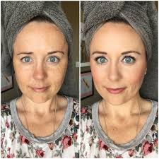 Before And After Using Limelight By Alcone Beauty Limelight Makeup Cosmetics Eye Makeup Tips Natural Face Moisturizer Dark Circles Makeup