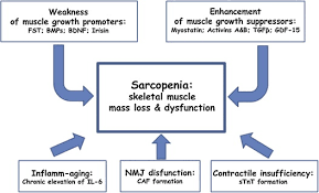 Ewgsop2's updated recommendations aim to increase awareness of sarcopenia and. Sarcopenia The Search For Emerging Biomarkers Sciencedirect