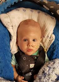 Born with his brain outside his skull