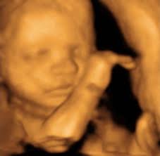 We did not find results for: 3d Ultrasound Photos 23 Weeks 27 Weeks Baby Impressions 4d Greenville Sc