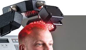 The only condition would be that the candidate does still have active follicles which produce vellus hair type. Laser Hair Loss Treatment Majestic Derma
