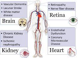 Small Vessel Disease In The Heart And Brain Current Knowledge Unmet Therapeutic Need And Future Directions Journal Of The American Heart Association