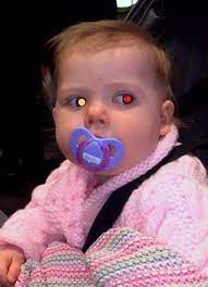 Learn the early signs in children and adults to avoid visual impairment. Baby Diagnosed With Deadly Eye Cancer After Photographer Spots White Glow In Her Eye In Holiday Snaps