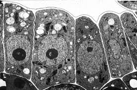 Electron micrographs of animal and plant cells: Biology 130 Lab 3 Electron Micrographs