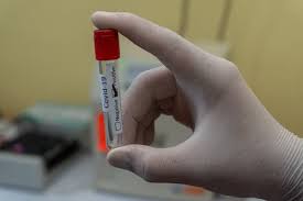 Where To Get Rapid Covid Testing In Nyc