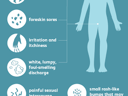 How long did it take jaime? Male Yeast Infection Causes And Symptoms