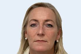 Profhilo behandeling Maastricht