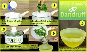 natural home remes for dandruff and