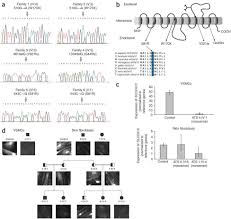 Mutations in the facilitative glucose transporter GLUT10 alter angiogenesis  and cause arterial tortuosity syndrome