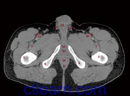 Functional anatomy of the male. Anatomy Ct Axial Abdomen And Pelvis Male