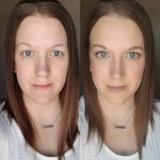 Lana Del Rey said yes to a less invasive cosmetic procedure. She shares  more in the comments below.