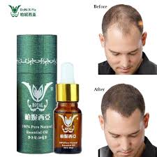 7 products that help hair grow faster. Hair Growth Products Natural With No Side Effects Faster Grow Hair Treatment Restore Regrowth Pilatory Anti Hair Loss Products Growth Chart Product Consignmentproduct Lcd Aliexpress