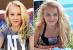 Traction Alopecia Jojo Siwa