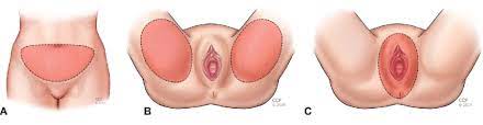 Learn about the female reproductive system's anatomy through diagrams and detailed facts. Defined Anatomic Locations Of The Suprapubic Area A Groin B And Download Scientific Diagram