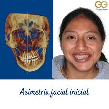 Galo Fernando Guzmán Castillo (@galofernandogc) • Instagram photos and  videos