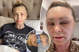 Tamra Judge savagely roasted by mom over plastic surgery recovery: 'Your  face literally makes me want to throw up' #RHOC #TamraJudge #RealityTV  #BravoTV #CelebrityNews #RealHousewives #RealHousewivesofOrangeCounty