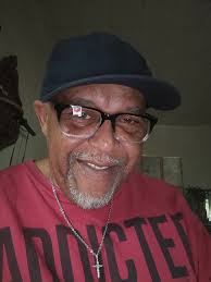 Gen X's 80s survival stories: scars from bike falls, table bumps, and Jax  ball chokes