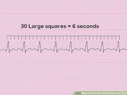 How To Measure And Calculate Heart Rate From Ecg Expert