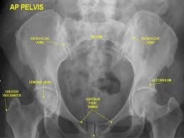 Check spelling or type a new query. Presentation1 Pptx Radiological Anatomy Of The Abdomen And Pelvis