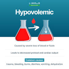 Image result for Shock