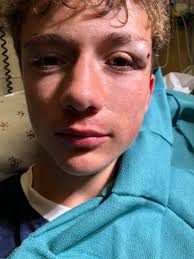 Operation Ward 57 Happy 3 Year Alive Day to Seth Pack! While out